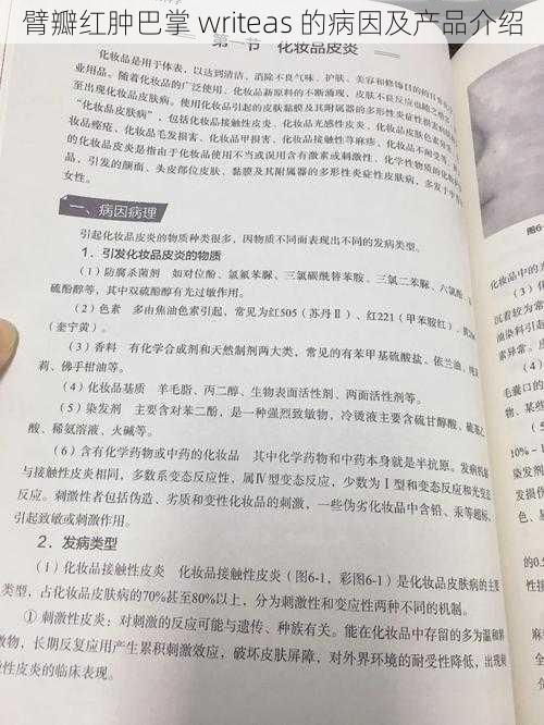 臂瓣红肿巴掌 writeas 的病因及产品介绍